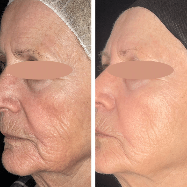 Before and After Image: ZO Skin Health - left-front-oblique